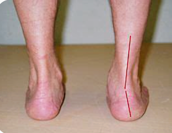 Bilan postural complet